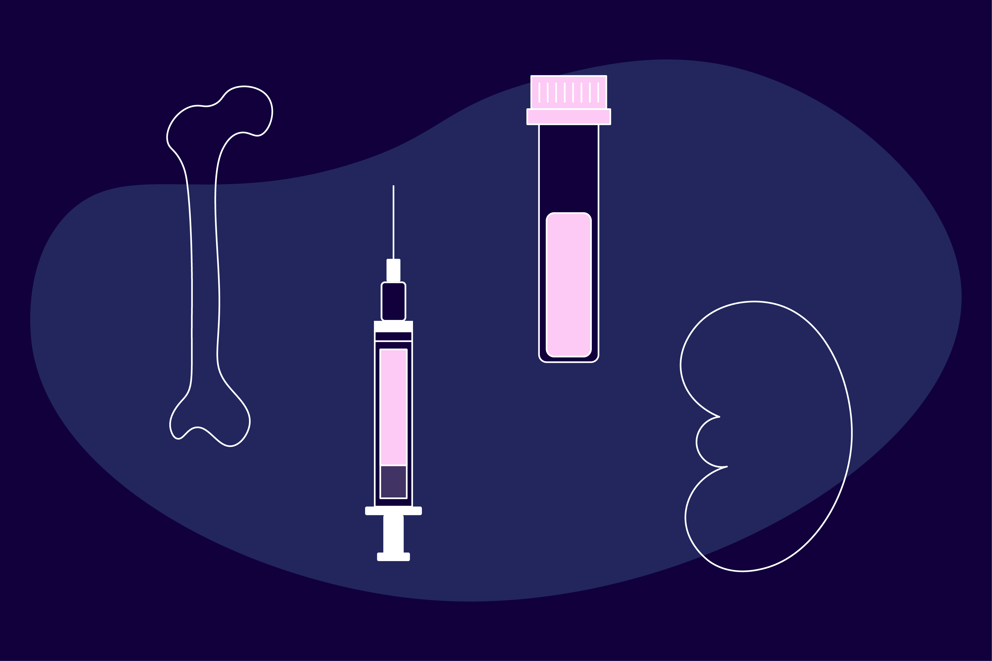 Bone Marrow Transplant illustration